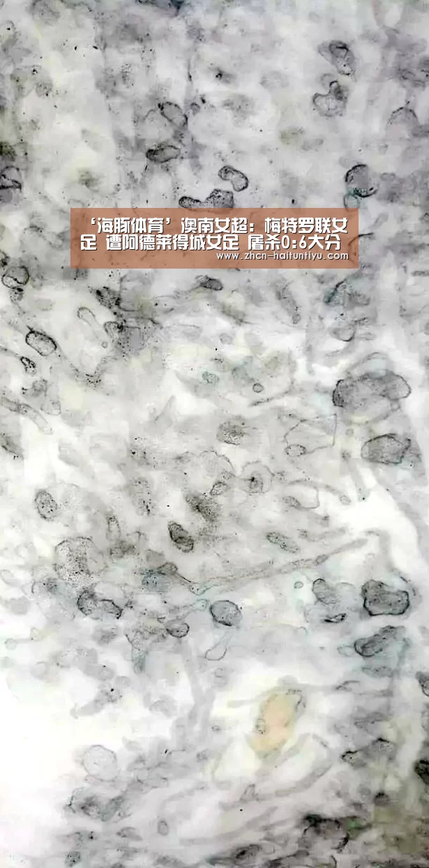 ‘海豚体育’澳南女超: 梅特罗联女足 遭阿德莱得城女足 屠杀0:6大分差失利(图2) 运动平台